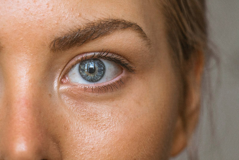 Contorno de ojos - ojeras y bolsas, causas explicadas